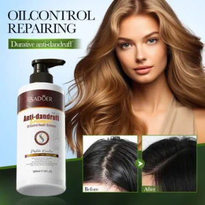 Collagen Shampoo for Dandruff & Oil Control Repair - SADOER