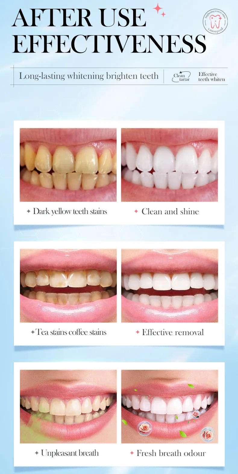 SADOER Rose Salt Whitening Toothpaste for Stain Removal & Gum Care 11 rose salt toothpaste SPU818898738847 12071