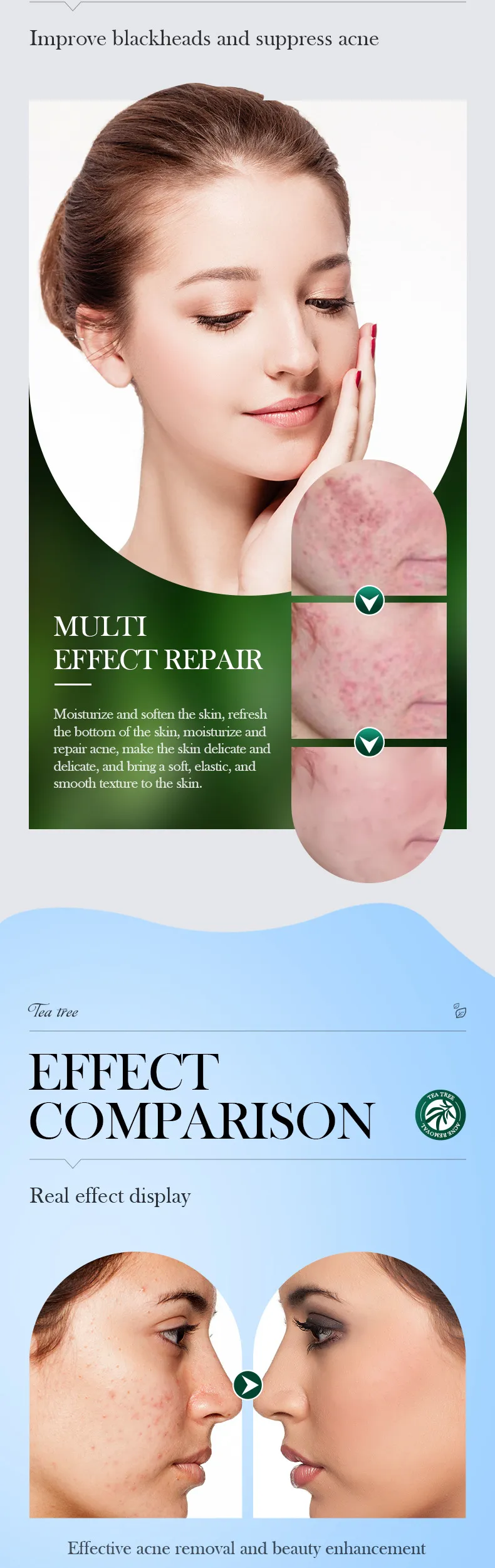 SADOER Tea Tree Skincare 5-Piece Cleansing and Hydrating Set 21 tea tree skincare set SPU717188548322 4546