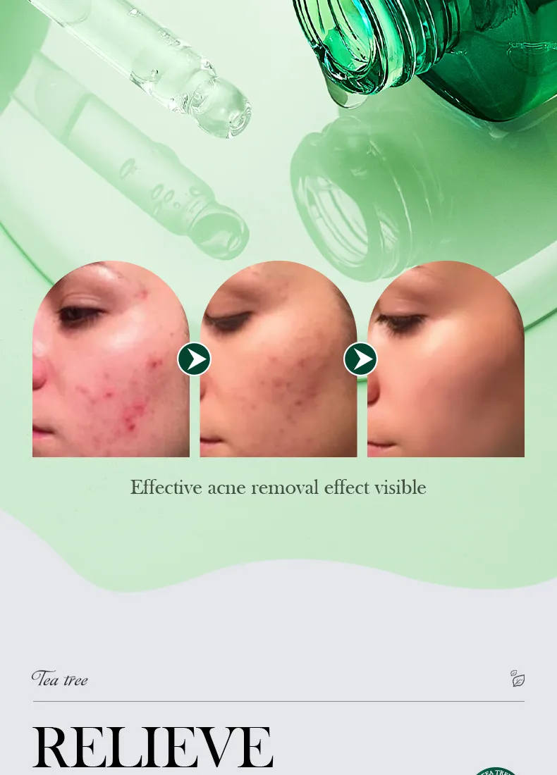 SADOER Tea Tree Skincare 5-Piece Cleansing and Hydrating Set 33 tea tree skincare set SPU717188548322 4558