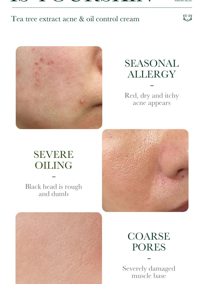 SADOER Tea Tree Skincare 5-Piece Cleansing and Hydrating Set 44 tea tree skincare set SPU717188548322 4569