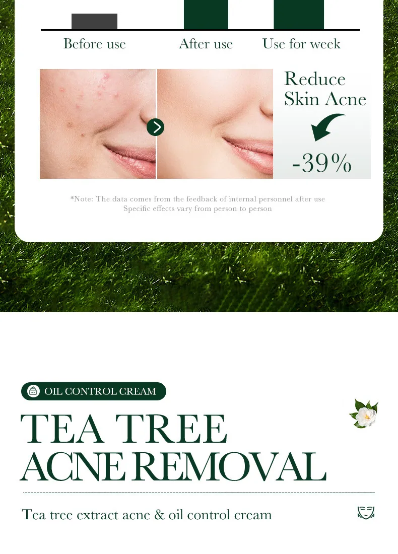 SADOER Tea Tree Skincare 5-Piece Cleansing and Hydrating Set 47 tea tree skincare set SPU717188548322 4572