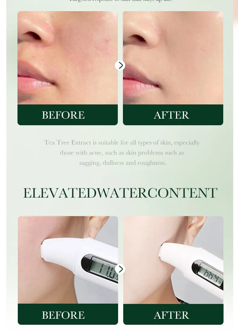 SADOER Tea Tree Skincare 5-Piece Cleansing and Hydrating Set 49 tea tree skincare set SPU717188548322 4574