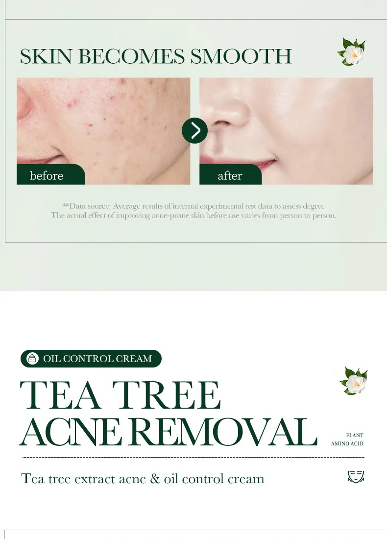 SADOER Tea Tree Skincare 5-Piece Cleansing and Hydrating Set 56 tea tree skincare set SPU717188548322 4581