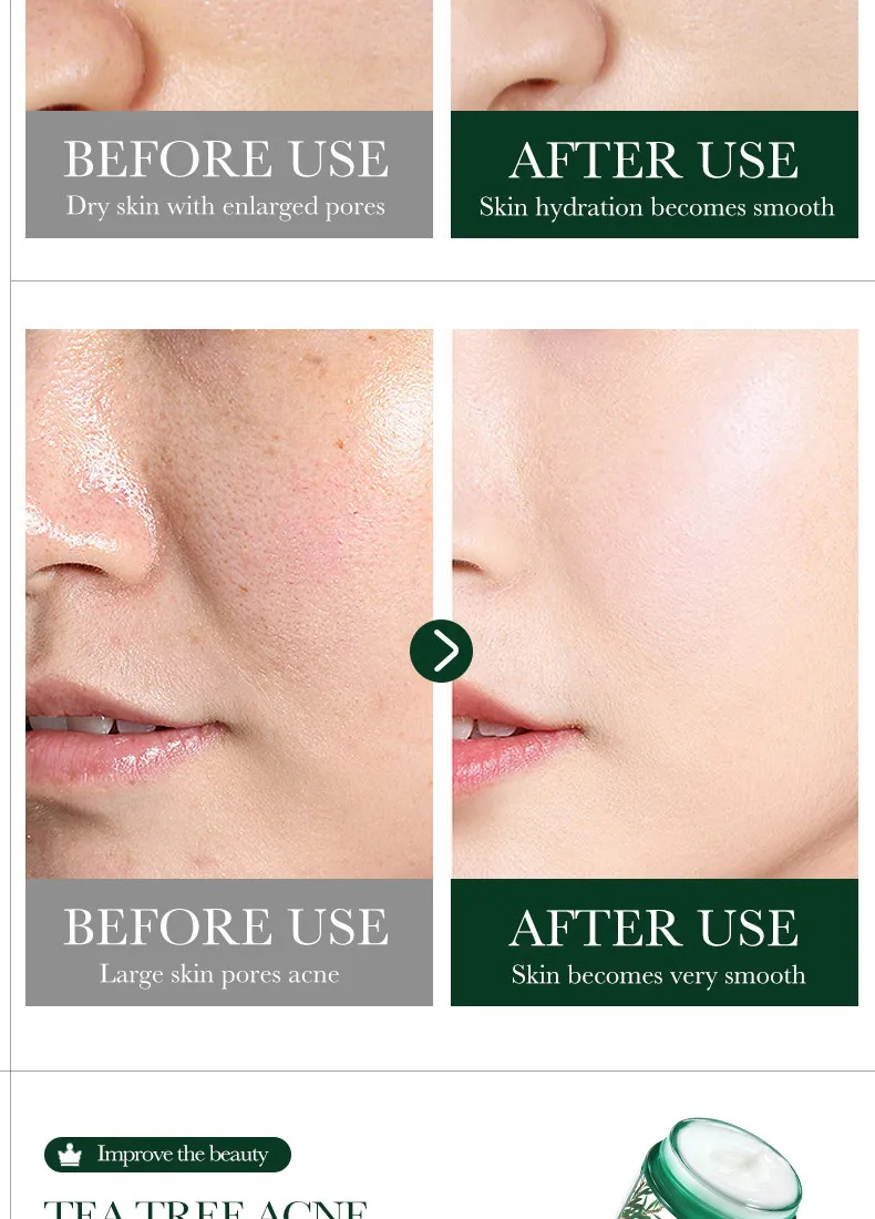 SADOER Tea Tree Skincare 5-Piece Cleansing and Hydrating Set 58 tea tree skincare set SPU717188548322 4583