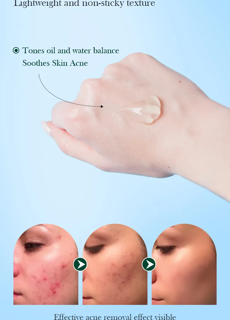 SADOER Tea Tree Skincare 5-Piece Cleansing and Hydrating Set 71 tea tree skincare set SPU717188548322 4596